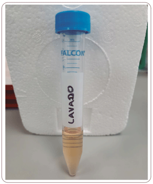 Figura 10. Medio de lavado en tubo de centrífuga de 15 mL.Foto: David Leonardo Gómez López