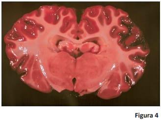 Prevención, diagnóstico y tratamiento de babesiosis y anaplasmosis - Image 4