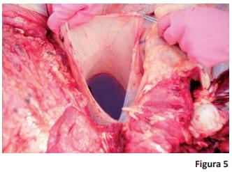 Prevención, diagnóstico y tratamiento de babesiosis y anaplasmosis - Image 5