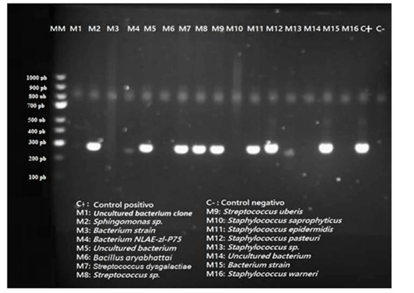 Figura 6 Gel de electroforesis que demuestra presencia/ausencia de gen de resistencia tetA para antibióticos de la familia de tetracilcinas 