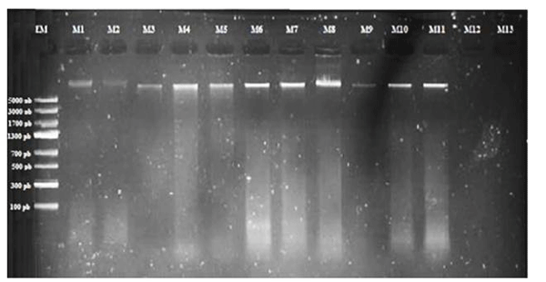 Figura 1 ADN total en gel de electroforesis