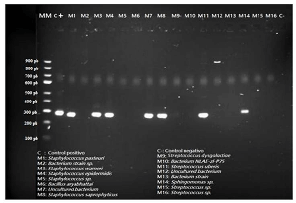 Figura 5 Gel de electroforesis que demuestra la presencia/ausencia del gen de resistencia blaTEM para antibióticos de la familia β-lactámicos.