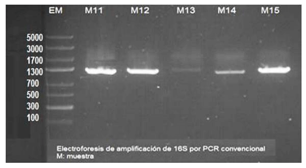 Figura 3 Electroforesis de amplificación de 16S por PCR convencional. 