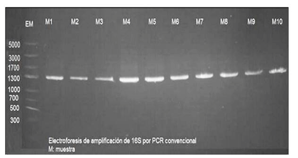 Figura 2 Electroforesis de amplificación de 16S por PCR convencional