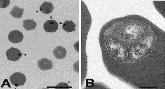 Anaplasmosis bovina: ¿Cómo controlarla? - Image 2