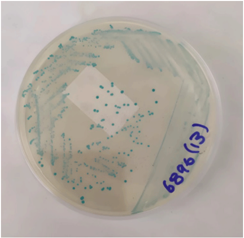 Figura 1 Colonias de E. coli de color azul verdoso en agar TBX+CFigure 1. Strains of E. coli in greenish blue color in TBX+C agar