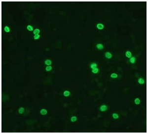 Figura 2. M u e s t ra p o si ti va a o o q ui s t e s d e Cryptosporidium spp. a través de la técnica de Inmunofluorescencia directa. 