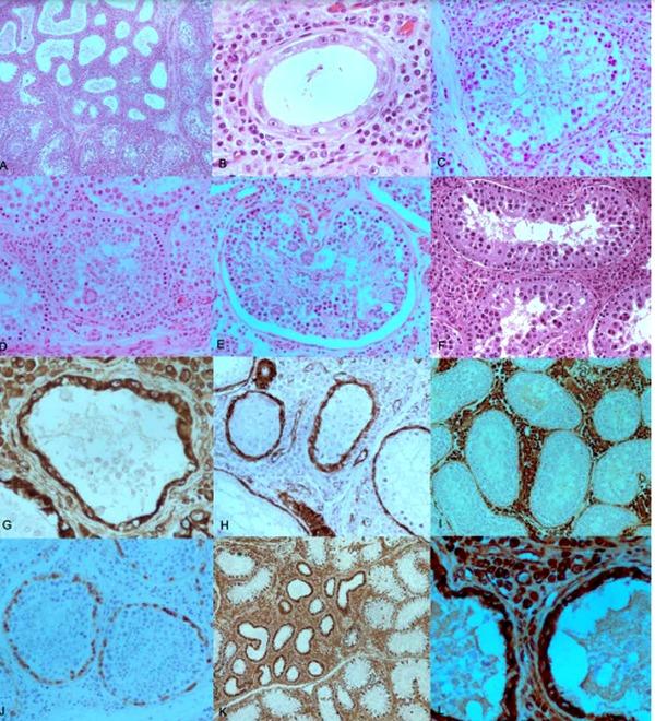 Estudios morfológicos e inmunohistoquímicos en testículos de verracos azoospérmicos - Image 1