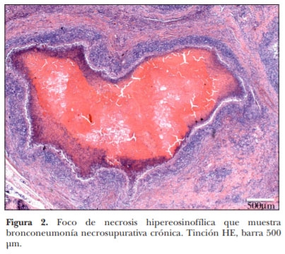 Demostración inmunohistoquímica de Mycoplasma bovis en lesiones neumónicas crónicas en ganado en corral de engorda - Image 3