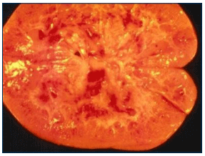 Figura 3. Riñón afectado por ocratoxinas.